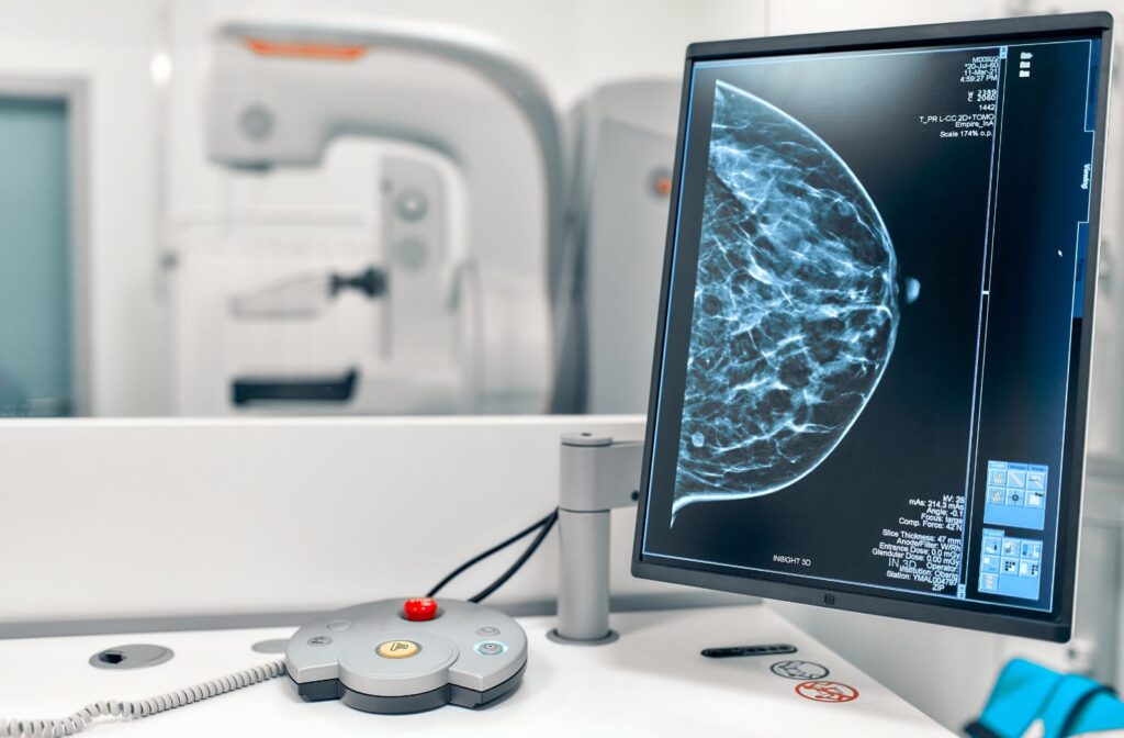 telemammography